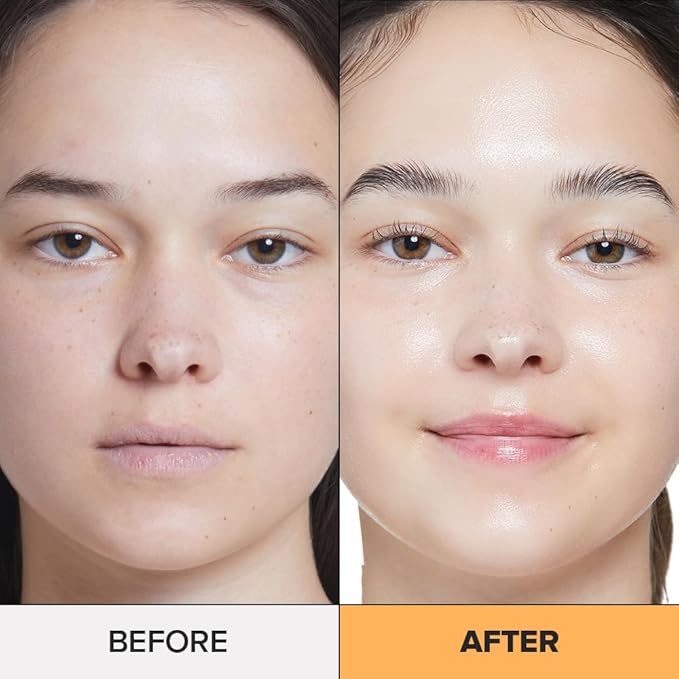 I DEW CARE Skin Care Set - Vitamin To Glow Pack | Niacinamide, Glass Skin Smoother, Vegan, Cruelty Free, Travel Size, Moisturizing Balm, For Dry Lips, Nourish and Hydrate, Illuminating