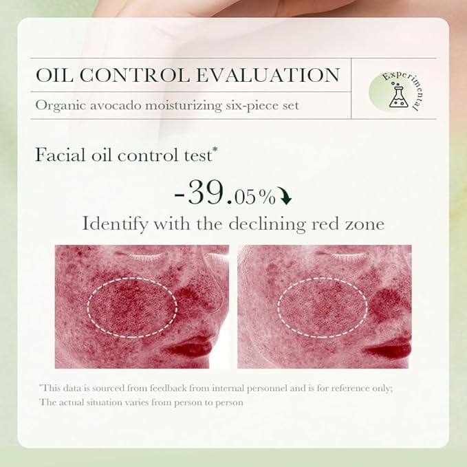 6pcs Avocado Skincare Kit, Skin Care Gift Set with Facial Cleanser, Toner, Lotion, Face Serum, Face Cream, Eye Cream For Hydrating Skin, Anti-Aging Skin For Women Teen Girls (Large, 6, Count)