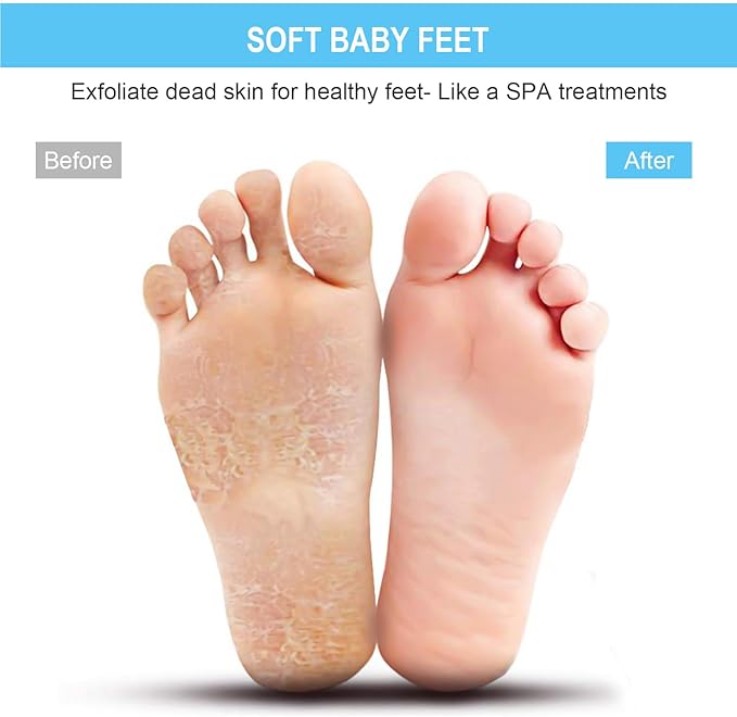 BESKAR XL Large Foot Scrubber Mat for Use in Shower - Shower Foot Cleaner to Eliminate Calluses Dead Skin, Foot Massager Mat for Men & Women to Soothe Achy Feet, Non Slip Suction Cups