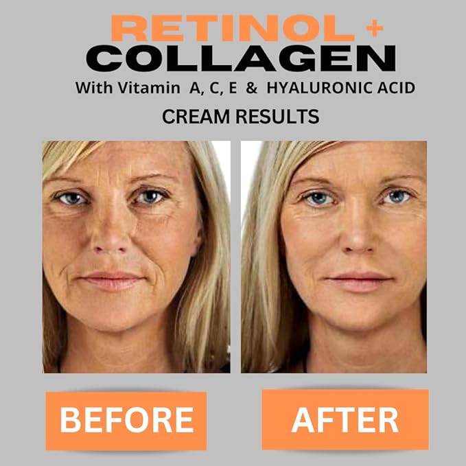 Retinol + Collagen, Hyaluronic Acid, Vitamin C Anti-Aging Face Cream, Day and Night Moisturizing Cream, Anti-Wrinkle Cream for Face, Firming Cream - 4oz