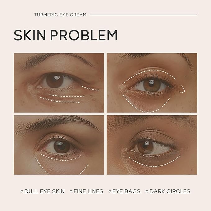 Turmeric Under Eye Cream, For Dull Eye Skin, Fine Lines, Eye Bags, Dark Circles, Eye Firming, Even Skin Tone, Hydrating, Moisturizes, Smooths Fine Lines Under Eye Serum, Turmeric Booster Eye Treatment Eye Cream