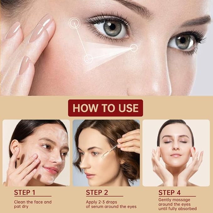 Chalazion Eye Treatment For Blepharitis, 30ml Moisturize Eyelids Serum and Chalazion Remover, Gentle Under Eye Relief Serum For Dark Circles, Eye Bags, Puffiness.