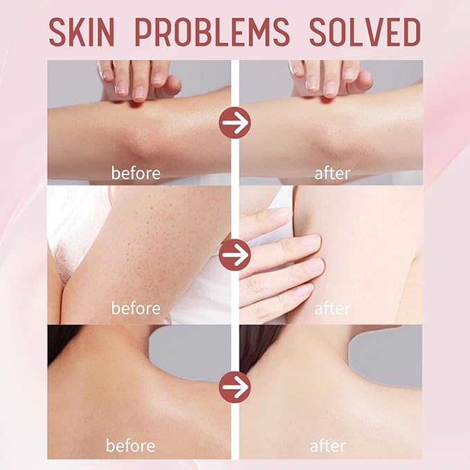 Whipped Shea Butter Skin Moisturizer - Body Butter for Women - Body Lotion for Dry Skin - Lightweight Body Cream for Women - Hydrating,Nourishing Soothing for All Skin Types - Birthday Christmas Gifts