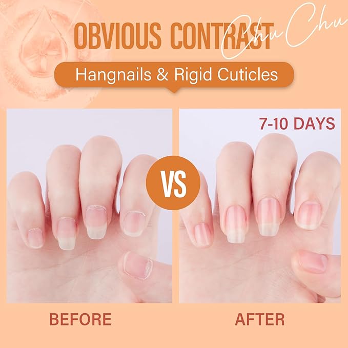 CHUCHU Organic Cuticle Oil for Nails: Orange Jojoba Nail Oil with Vitamin B & E - Moisturizes Repairs and Promotes Nail Growth - Prevents Dryness Hangnails and Chapped Skin 15ML