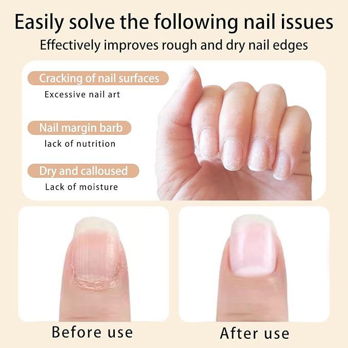 Scents Cuticle Oil Pen for Nails Care,Nail Oil For Strength,Nourish Moisten Care Cuticle To Reduce Nail Cracking and Dry for Weak Peeling Brittle and Thin Nails（apple&Strawberries&peaches）