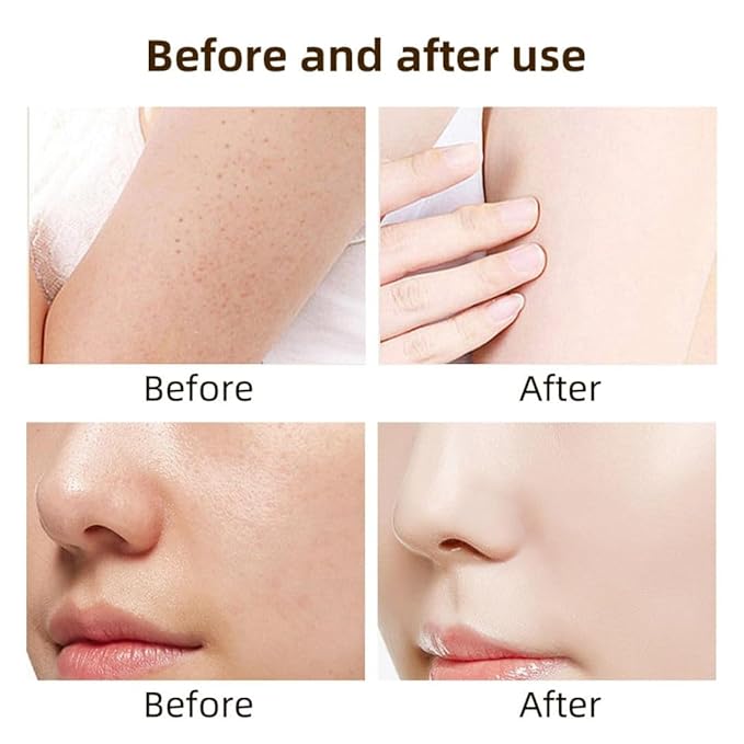 Snail Mucin Skincare Bundle – Complete 4-Step Routine with Snail Mucin Serum, Toner, Gel Cleanser, and Moisturizing Cream for Hydrated, Glowing, and Youthful Skin