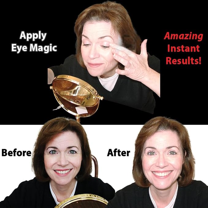 Original Eye Lift Kit (Small/Medium Size With Gel) Lifts Eyelid Droop and Hooded Eyes | Open And Show Off Your Beautiful Eyes | Made In America