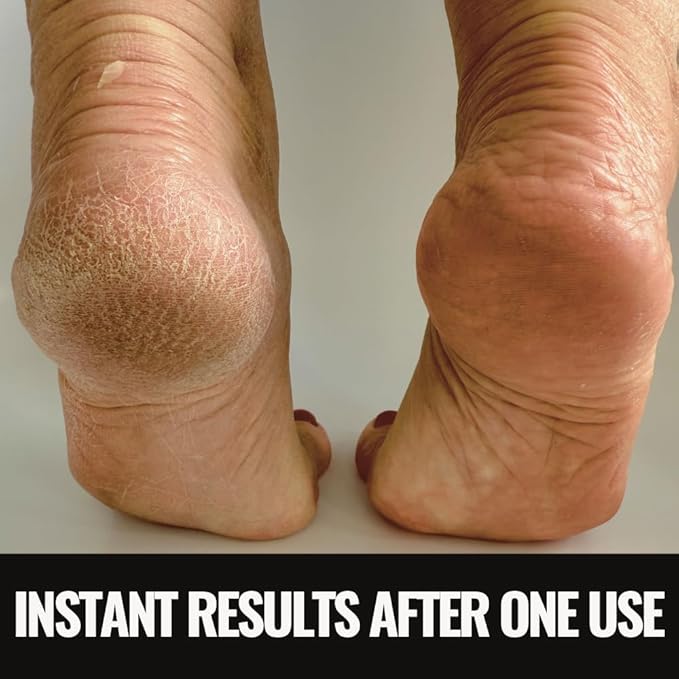 SandBar Heel Revival Regimen Mother's Day Gift - Home Pedicure Kit, Foot Spa Kit Pedicure Set, Foot Care Products for Soft, Smooth, Callus-Free Feet - Morning Glory