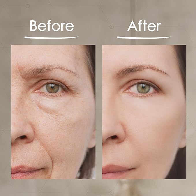 MaxiLift Serum, Instant Face Lift Cream, Skin Serum for Face & Instant Eye Lift, Smooth & Firm Loose Sagging Skin, Fine Lines & Wrinkles Within 2 Minutes, 0.5 Fl Oz (Set of 3)