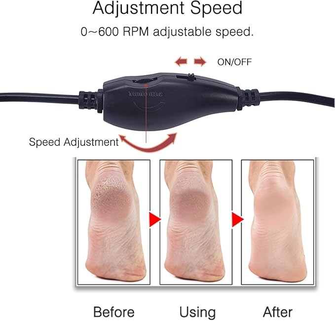 Electronic Foot File Grinder (Speed Adjustable) with 60pcs Replacement Sandpaper Disk，Electric Foot Scrubber Dead Skin Remover，for Feet Hard Cracked Dry Dead Skin Exfoliation，Unisex（Rose Pink）