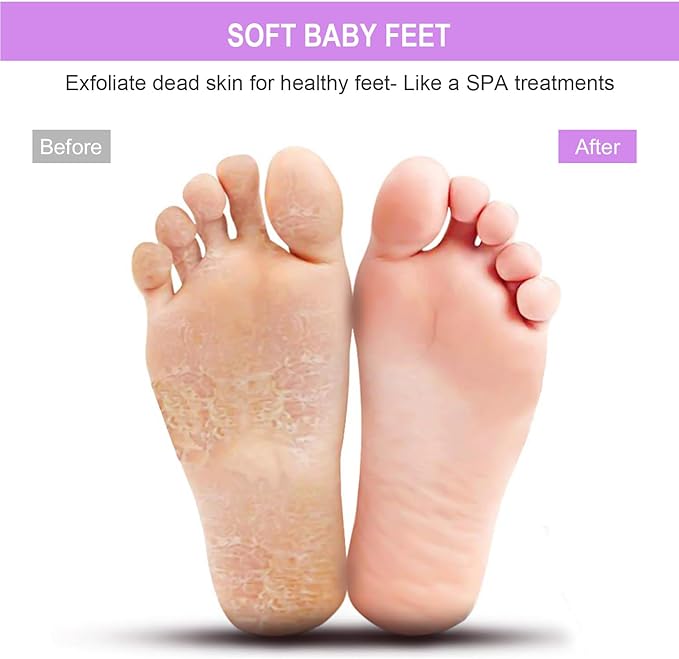 BESKAR XL Large Foot Scrubber Mat for Use in Shower - Shower Foot Cleaner to Eliminate Calluses Dead Skin, Foot Massager Mat for Men & Women to Soothe Achy Feet, Non Slip Suction Cups