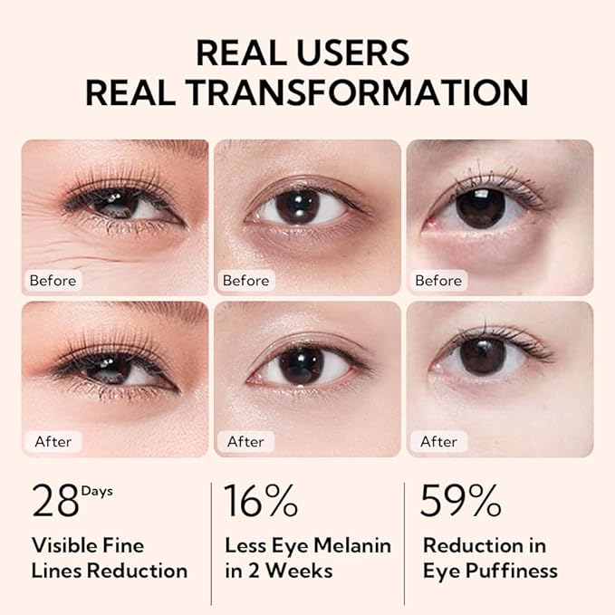 LANBENA Eye Cream for Wrinkles,Anti-Aging Eye Cream with Vitamin C,Reduce Fine Lines,Firm Eye Skin,Puffy Eyes and Dark Circles Treatments