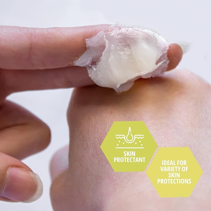 MED PRIDE Petroleum Jelly Cocoa Butter Large Tub Skin Moisturizer & Protectant for Dry Skin, Burns, Rashes, Wounds