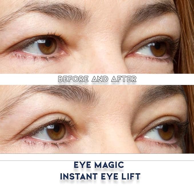 Premium Eyelid Lift (L/XL Kit + Gel) Made in the USA. Lifts and Defines Droopy, Sagging or Hooded Eyes Safe for Daily Use