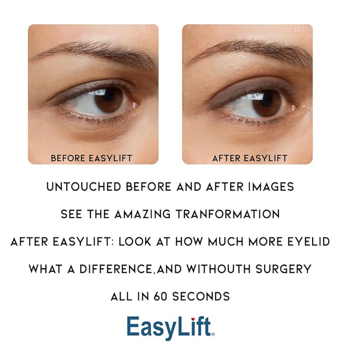 Original Eye Lift Kit (Small/Medium Size With Gel) Lifts Eyelid Droop and Hooded Eyes | Open And Show Off Your Beautiful Eyes | Made In America