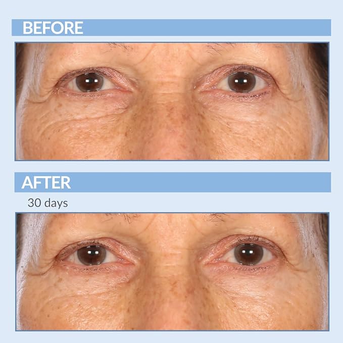 Vitamin A Force XR Retinol Serum Concentrate - Micro Exfoliate & Resurface for Radiant Skin - For Lines, Wrinkles - Pore Minimizer - Encapsulated Retinol for Anti-Aging - Serious Skincare - 1 Oz.