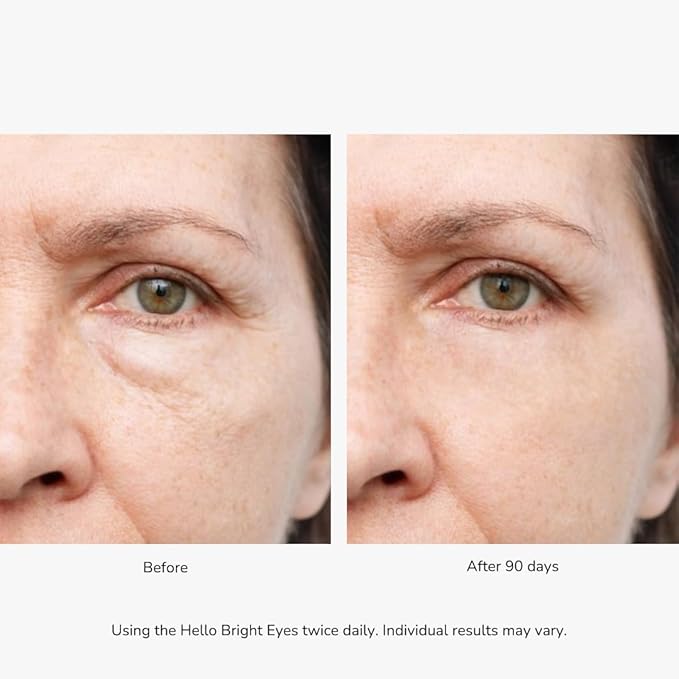 Emani Hello Bright Eyes - Vitamin C Super Eye Cream - Caffeine and Turmeric, Anti-Aging Eye Cream for Dark Circles, Puffiness, Wrinkles, Firming, Hydrating & Smoothing - Reduce Fine Lines 1 oz 30ml