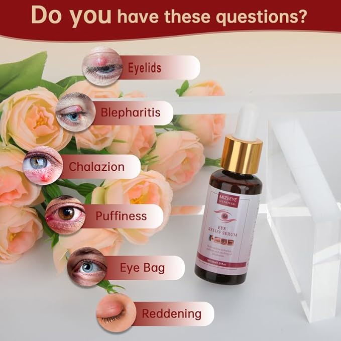 Chalazion Eye Treatment For Blepharitis, 2 PCS Moisturize Eyelids Serum and Chalazion Remover, Gentle Under Eye Relief Serum For Dark Circles, Eye Bags, Puffiness.