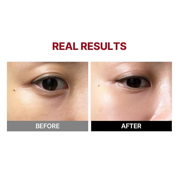 MEDITHERAPY Wrinkle-fit Tangle Eye Patch - Under Eye Patches for Dark Circles and Puffy Eyes - Eye Bags Treatment for Women - Mega Collagen Gel Pads for Puffiness - Firming & Deep Hydrating - 4EA