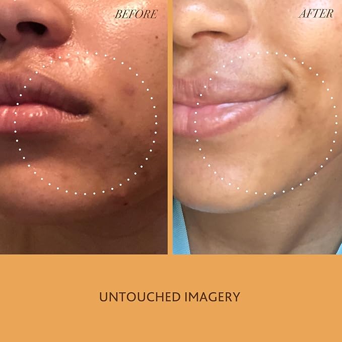 Golden Milk Cleanser Skin Care Gentle Milk Cleanser | Nourishing and Calming for Sensitive Skin 120 ml 4floz