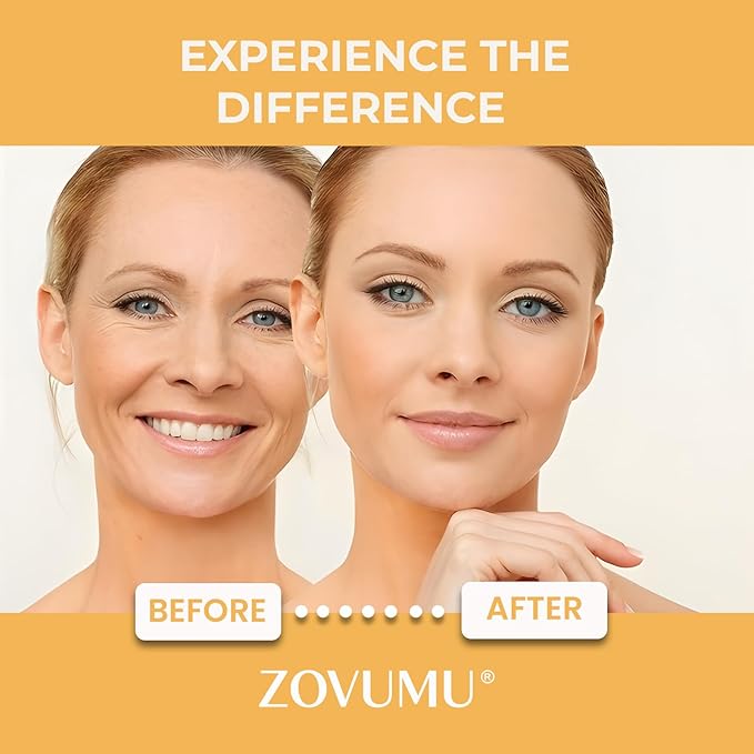 Under Eye Patches (30 Pairs) 24K Gold Skin Care Eye Mask - Puffy Eyes & Dark Circles Treatments - Eye patches Pads With Collagen, Hyaluronic Acid & Castor Oil, Skin Care for Men & Women Gift