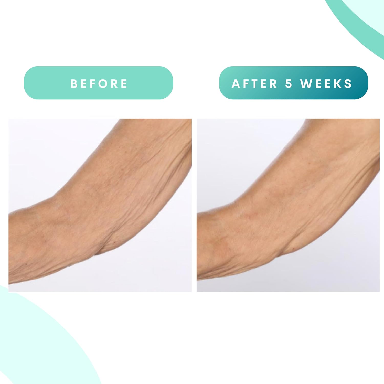 Serious Skincare - Glycolic Firming Retexturizing Body Cream - Moisturizing - Hydrating for Dry Skin - BODY FIT™ - For Crepey and Sagging Skin - Gentle Exfoliation for Smoother Skin - 8 Fl. Oz.