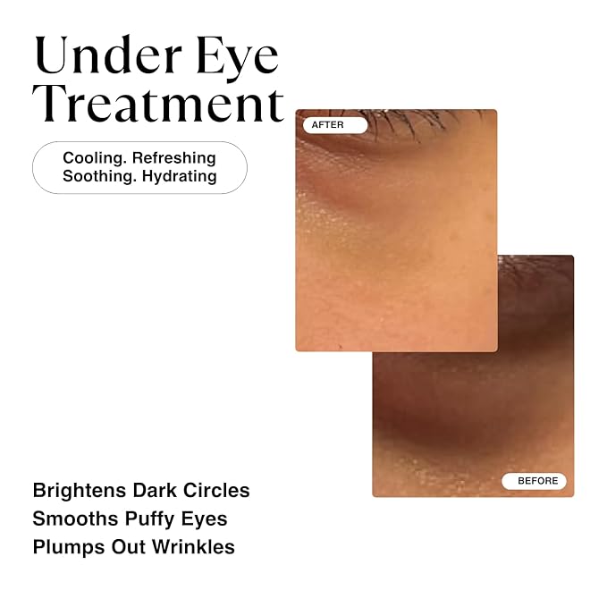 MATKAS Korean Vitamin C & Caffeine Eye Cream for Dark Circles and Puffiness 0.5 Fl Oz - Dark Circles Under Eye Treatment, Under Eyes Cream Anti Aging with Shea Butter Vitamin E for Puffy Eyes Wrinkles