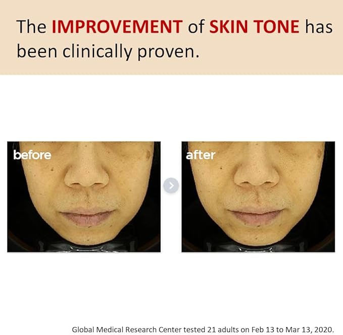 [Make p:rem] Poncirus trifoliata C Dark spot serum | Skin clearing serum | Uneven Skin Tone Treatment | Vitamin serum C face | 40ml, 1.35 fl.oz. | Make P:REM