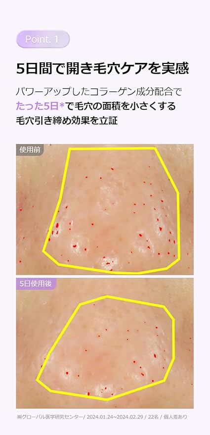 Probioderm™ Collagen Remodeling Serum 1.01 fl oz (30 ml) | Skin Firming Serum with Collagen & 12 Peptides for Pore Tightening & Smoothing | Hydrating & Lifting for Daily Skincare