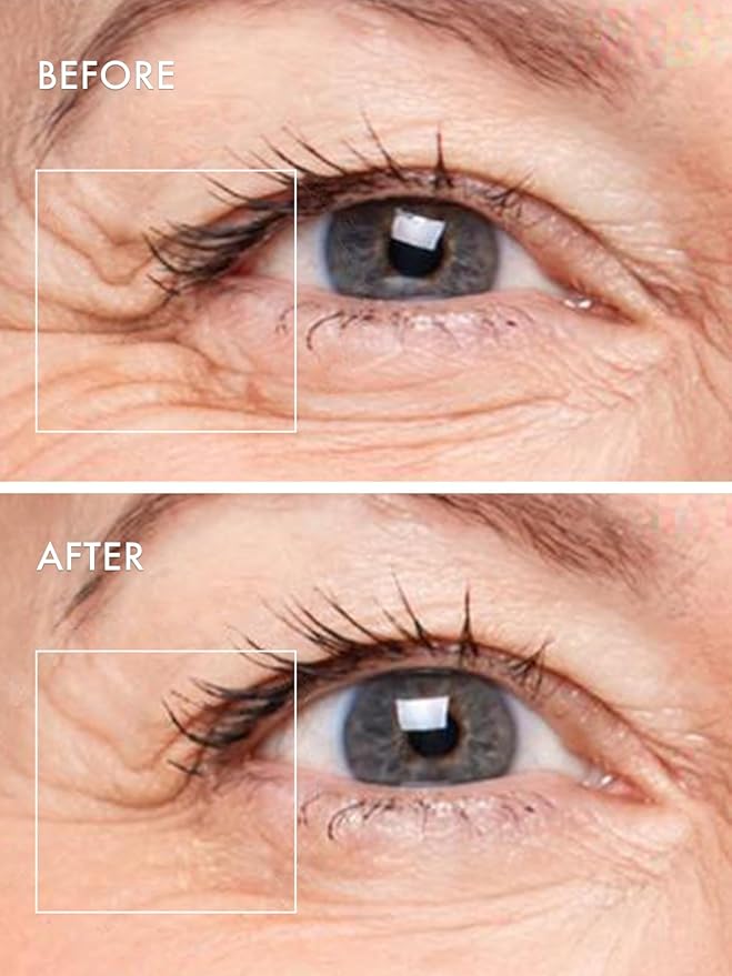 depology Deepcare+ Serum-Infused Micro Dart Patche | 4 Pairs Eye Mask | Under Eye Patches for Wrinkles | Fine Lines | Hydrating Eye Mask with Peptides | Amino Acids | and Synthesized Molecules