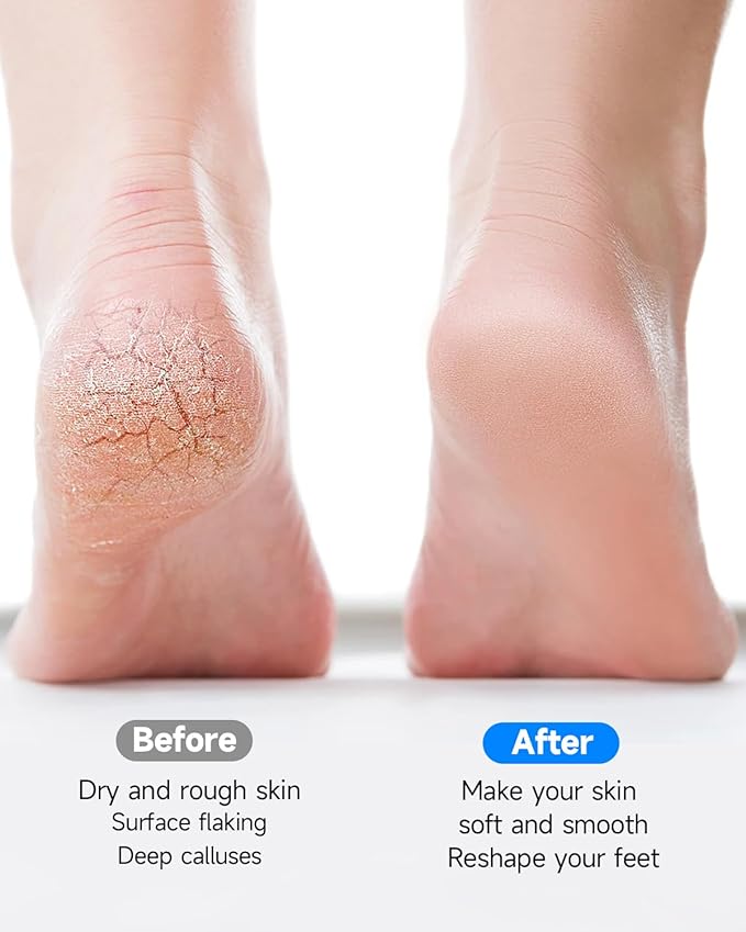 Electric Foot Callus Removers Rechargeable,Portable Electronic Foot Filer, Electric Callus Remover Kit,Professional Pedi Feet Care Perfect for Dead,Hard Cracked Dry Skin Ideal Gift(2 Grinding Heads)