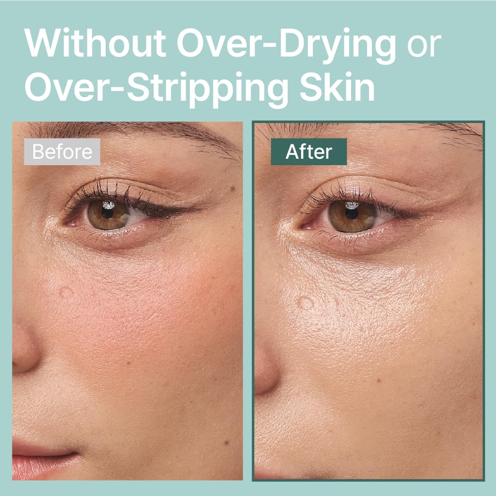 Illiyoon Gentle Deep Facial Cleanser | Low pH Gel-to-Foam Face Wash for Sensitive Skin, Hydrating Gel Cleanser & Daily Makeup Remover, Korean Skincare, 8.45 fl.oz.