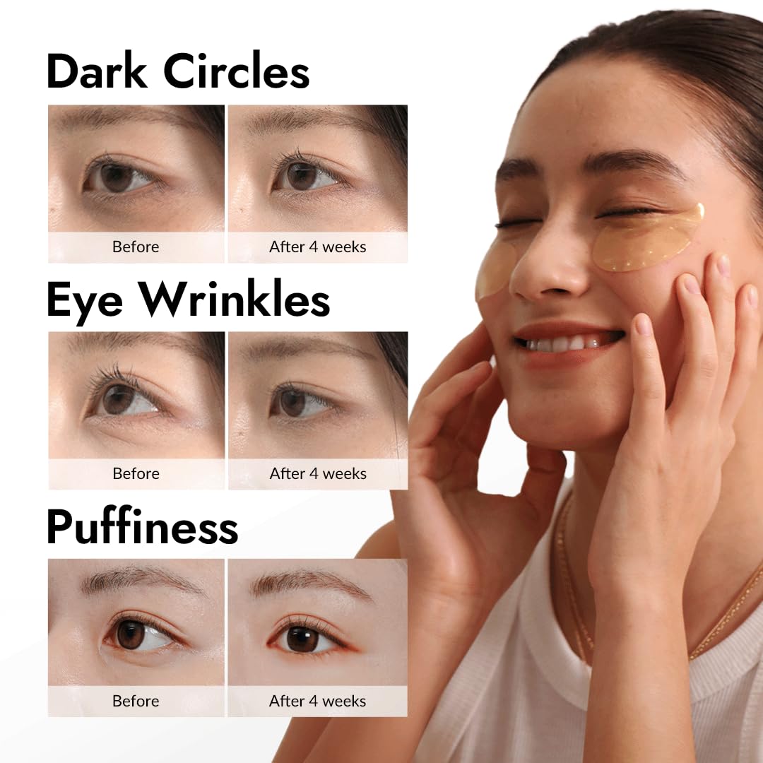 MIZON Under Eye Patches for Puffy Eyes & Dark Circles, 24K Gold & Snail Mucin, 60 Pcs – Anti-Wrinkle Collagen & Peptide Formula – Moisturizing Korean Eye Mask for Elasticity