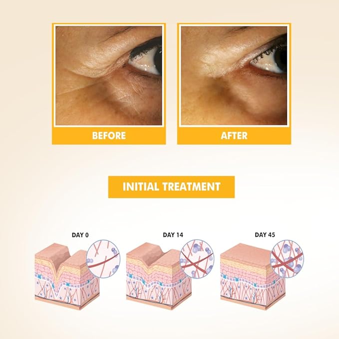 SKIN CARE - Eye Serum with Vitamin C & E, Hyaluronic Acid, Caffeine, and Swiss Apple Stem Cells - Day & Night