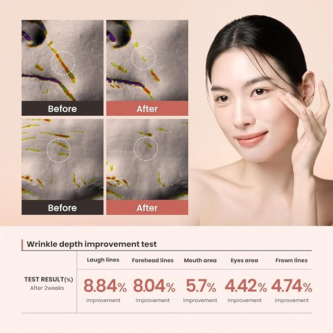 Plan Tox Lifting Serum – 30ml (1.01 fl oz) Skin Treatment with Spilanthes, Peptides, Collagen, and Botanicals – Firming, Wrinkle Care, Pore Minimizer, Skin Firmness, Hydrating