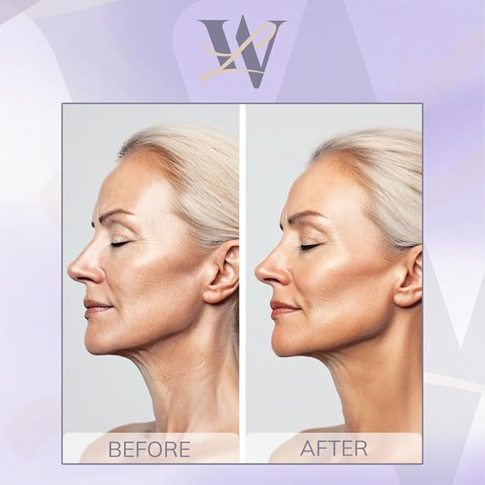 Reusable Neck Wrinkle Patches 6Pcs, Anti Wrinkle Patches, Face Tape for Wrinkles Overnight, Silicone Neck Patches, Silicone Wrinkle Patches for Neck Overnight, Silicone Patches for Wrinkles