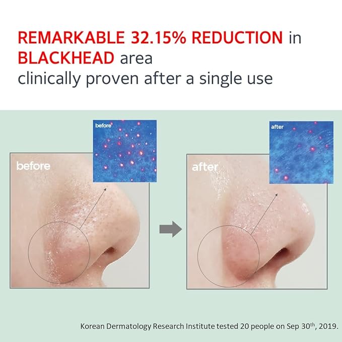 MAKE P:REM Safe Me. Relief Moisture Cleansing Oil, Deep Pore Cleansing Makeup Remover for Oily Skin, All Skin Types, Gentle Blackhead Remover, Korean Skin Care, 210ml, 7.1 Fl.Oz.