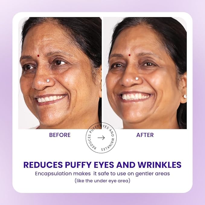 TRUTH & BEAUTY Advanced Smart Ageing Complex Serum 0.2% Retinal, 0.5% Bakuchiol for Fine Lines Wrinkles and Skin Smoothing Hydrate Face Serum for All Skin Types (1.01 Fl OZ) Fragrance Free