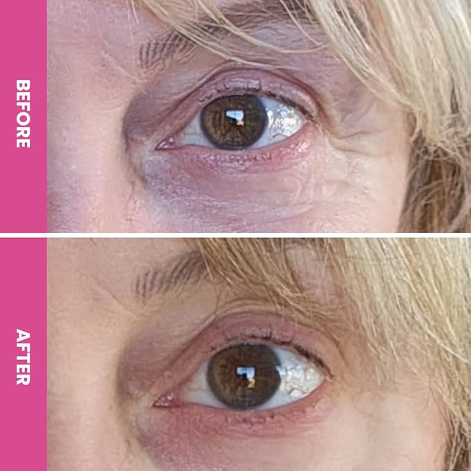 PrimeEyes Hydrate Under Eye Cream for Mature Women – Hydrating Eye Cream for Dark Circles and Wrinkle Repair – Soft, Glowing & Healthy Under Eyes