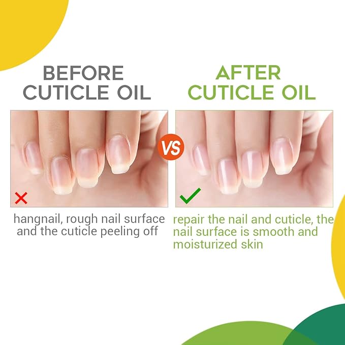 modelones Cuticle Oil and Nail strengthener, 15ml Nail & Cuticle Care Strengthener Oil Vitamin E + B Cuticle Revitalizing Oil for Nail Growth and Gel Nail Polish