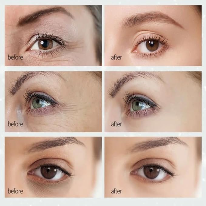 Under Eye Patches (15 Pairs) - Collagen Crystal Eye Mask, Under Eye Mask for Face Care, Eye Masks for Puffiness and Dark Circles, Firming, Moisturizing Eye Mask for Beauty