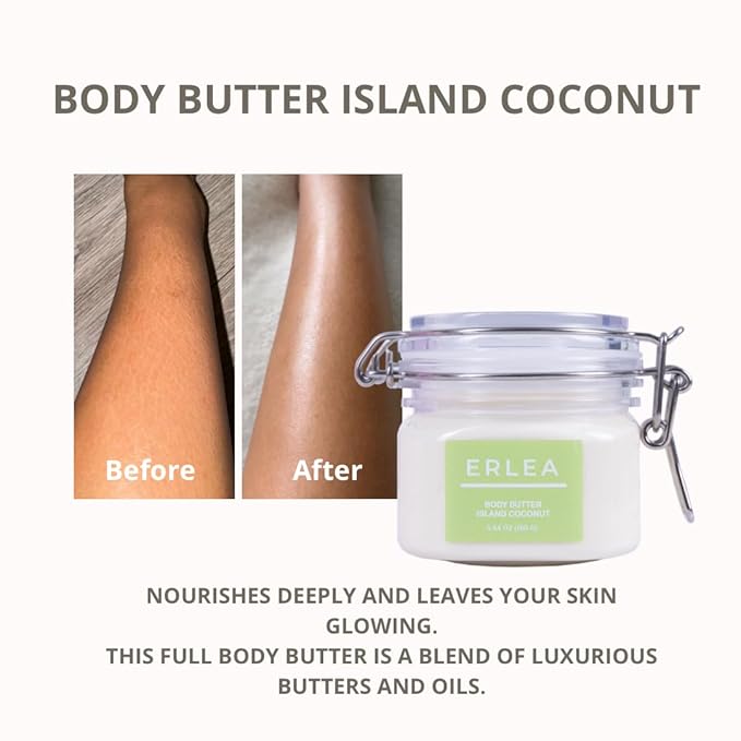 Erlea Coconut Body Butter 160 g/5.64 oz – Shea Butter, Body Butter for Women, Coconut Butter,Skin Care for Extremy Dry Skin, Organic Shea Butter, Body Care for Cracked Feet
