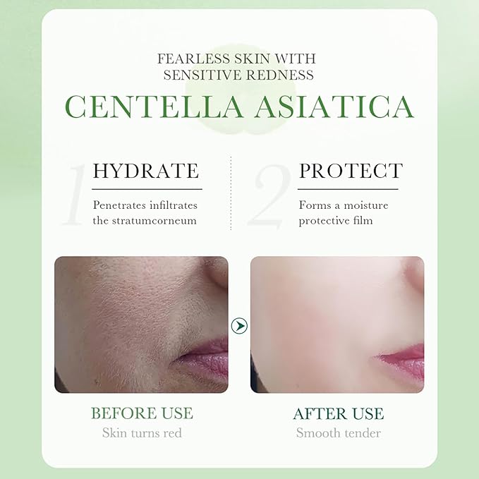 BIOAQUA Centella Asiatica Soothing Repair Facial Serum Nourish Oil Control Anti-Acne Face Skin Care 30ml / 1fl.oz