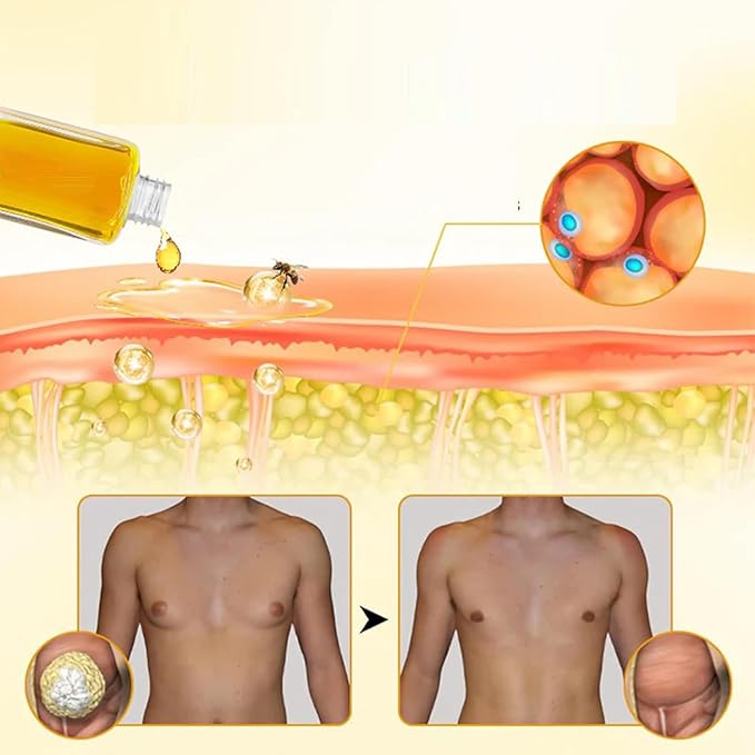 ThermoFirm Bee Venom Gynecomastia Oil, 2025 New Chest Muscles Bee Venom Oil,Strengthen The Chest Muscles (2 Bottle)