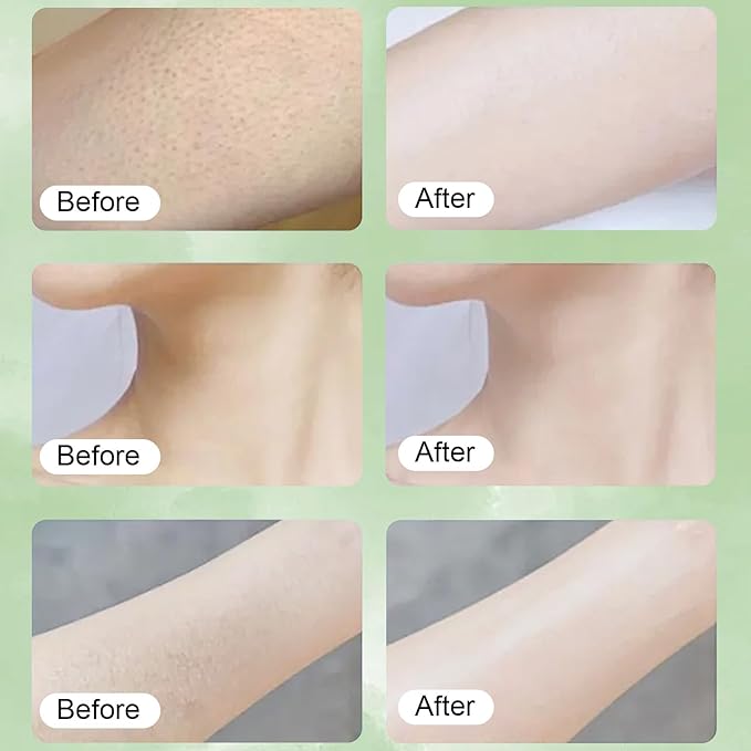 Neuropathy Cream, Magnesium Cream for Neuropathy,Magnesium Body Butter,Long-Lasting Hydration to Keep Skin Feeling Soft,Suitable for All Skin Types（2pcs）