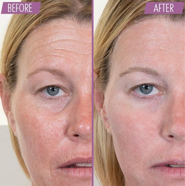 ATHENA 7 MINUTE LIFT - Results in 7 minutes - Eye, Neck, Face Tightening, Lifting & Firming Serum - Wrinkle Cream - ALL ORGANIC