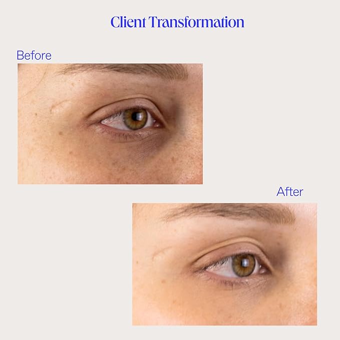 BioRepublic Lost Baggage Under Eye Emergency Repair Mask | Reduces Appearance of Lines, Bags, and Dark Circles Under Eyes | Organic Biocellulose Masks for Moisturization | Box of 3