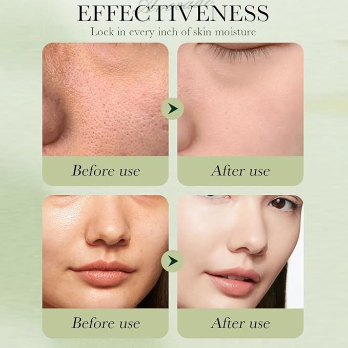 6pcs Avocado Skincare Kit, Skin Care Gift Set with Facial Cleanser, Toner, Lotion, Face Serum, Face Cream, Eye Cream For Hydrating Skin, Anti-Aging Skin For Women Teen Girls (Large, 6, Count)