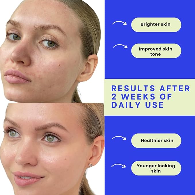 Vitamin C+E Ferulic Acid Serum – Brightening Anti-Aging Face Serum with CoQ10, Niacinamide & Resveratrol – Targets Wrinkles, Hydrates, Evens Tone – Clean, Lightweight, All Skin Types