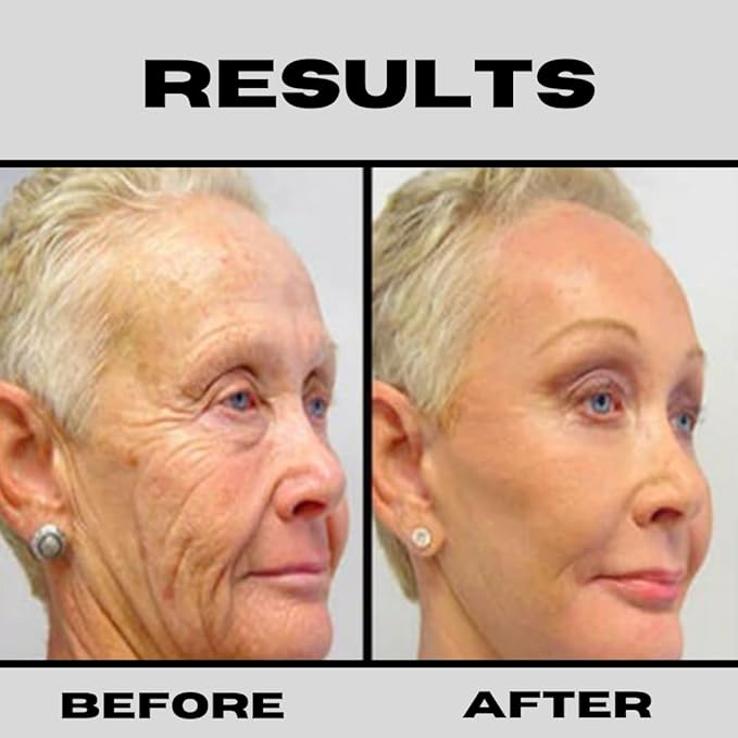 Retinol + Niacinamide B3, Vitamin C, Hyaluronic Acid Serum, Anti-Aging Serum for face, Brightening Firming Hydrating Serum, Fine lines and Wrinkle Face Serum - 8oz